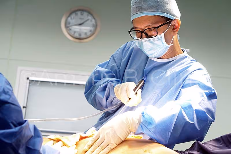Dr Ivan Puah, liposuction doctor in Singapore, in an operating theatre