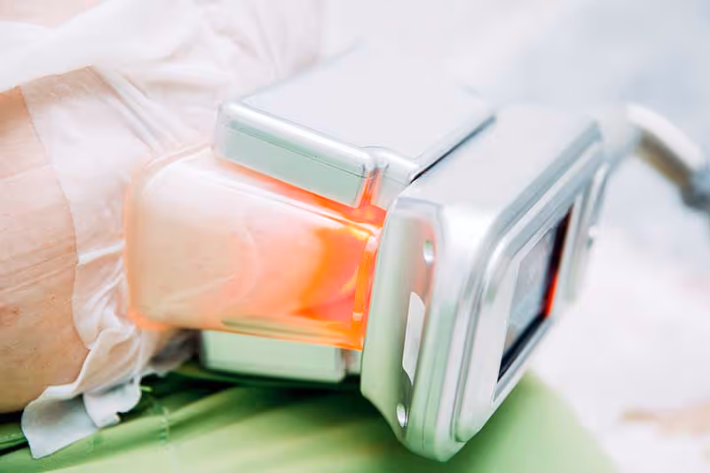 Paradoxical Adipose Hyperplasia (PAH): The Ugly & Permanent Side Effect of Fat Freezing/Cryolipolysis