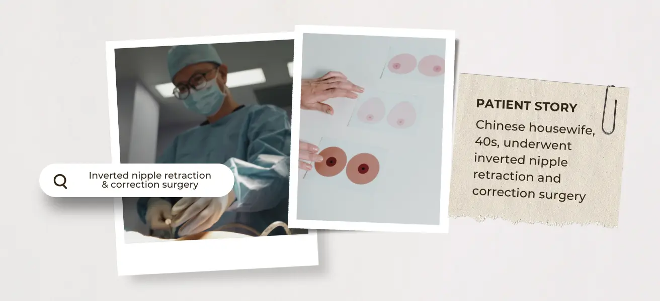 inverted nipple retraction and correction surgery