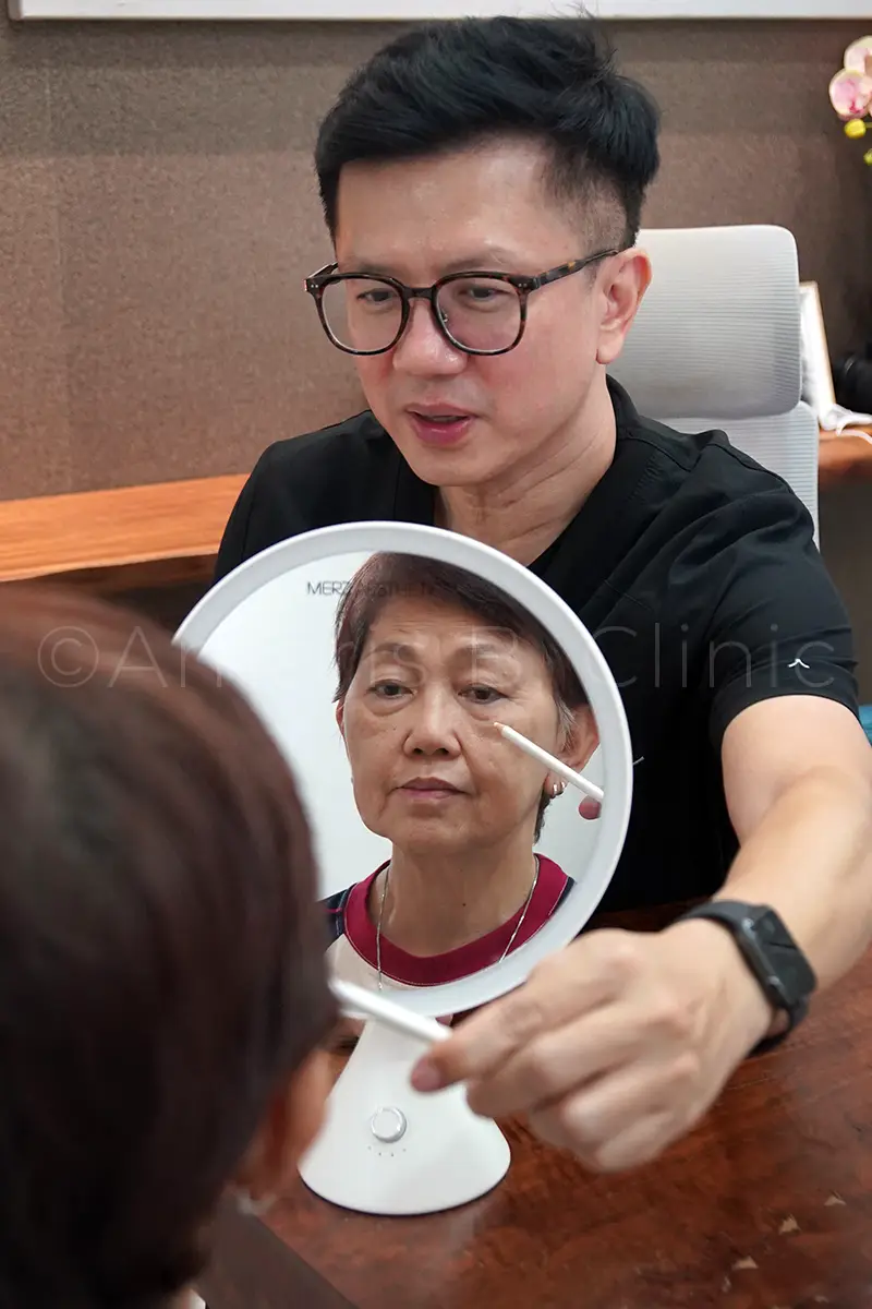 68 year-old retiree reversed facial ageing signs with Ultherapy Prime 