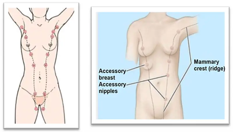 Accessory breast milk line diagram
