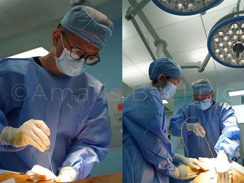 Asian Man Overcomes Genetic Fat Deposit with Male Waistline Sculpting For a Masculine V-shape Torso