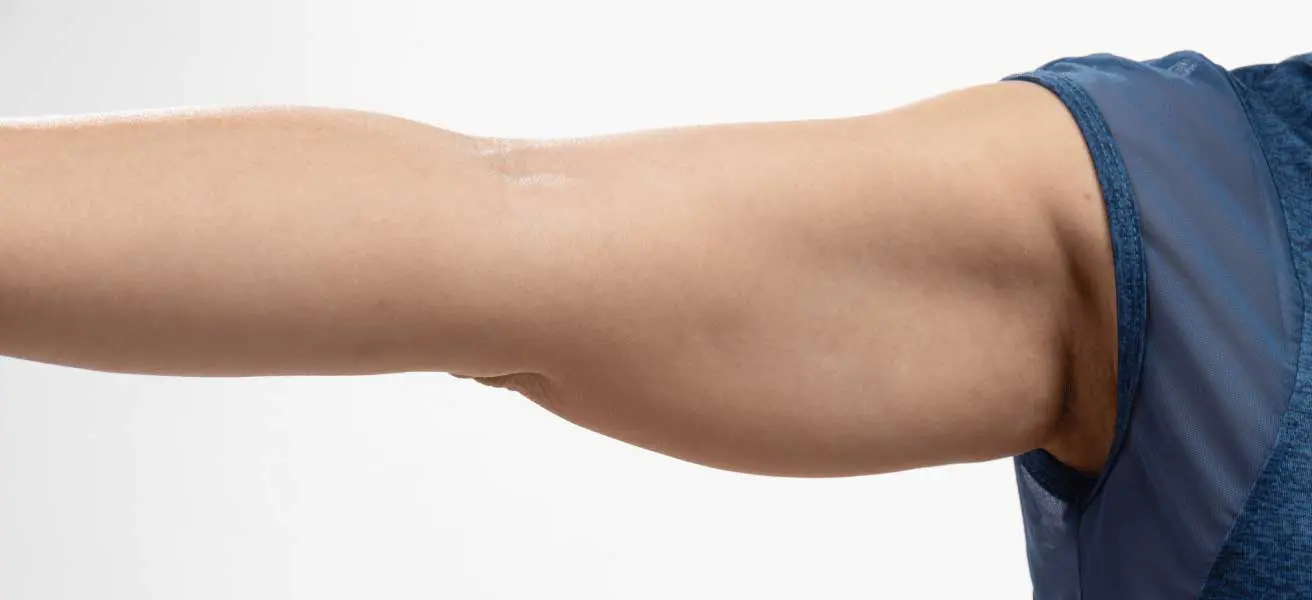 Arm Fat Singapore Women Consultations Clinic Data