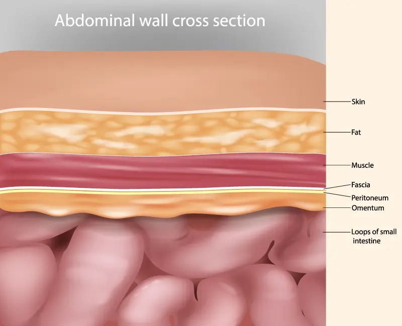 Abdominal wall cross section