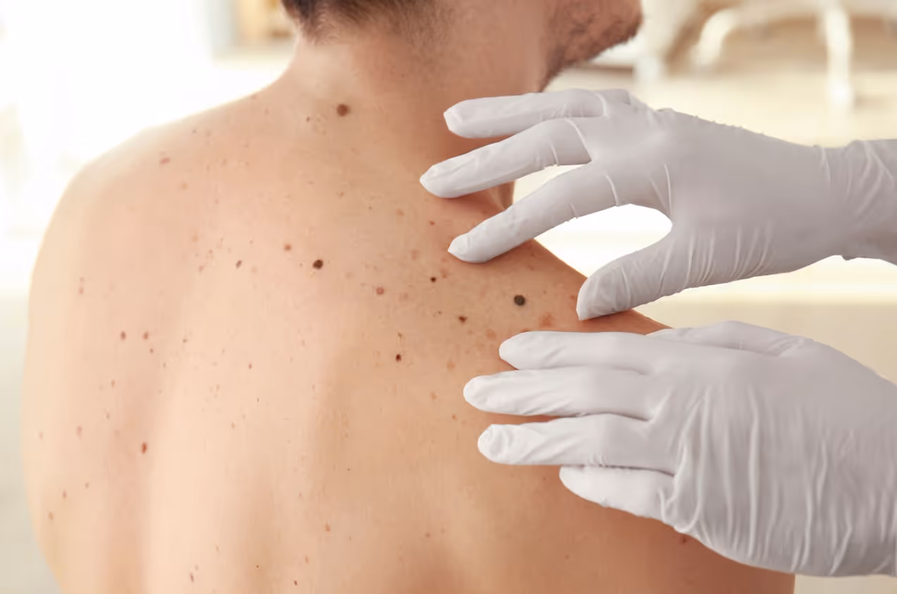 concerned about spot on your skin