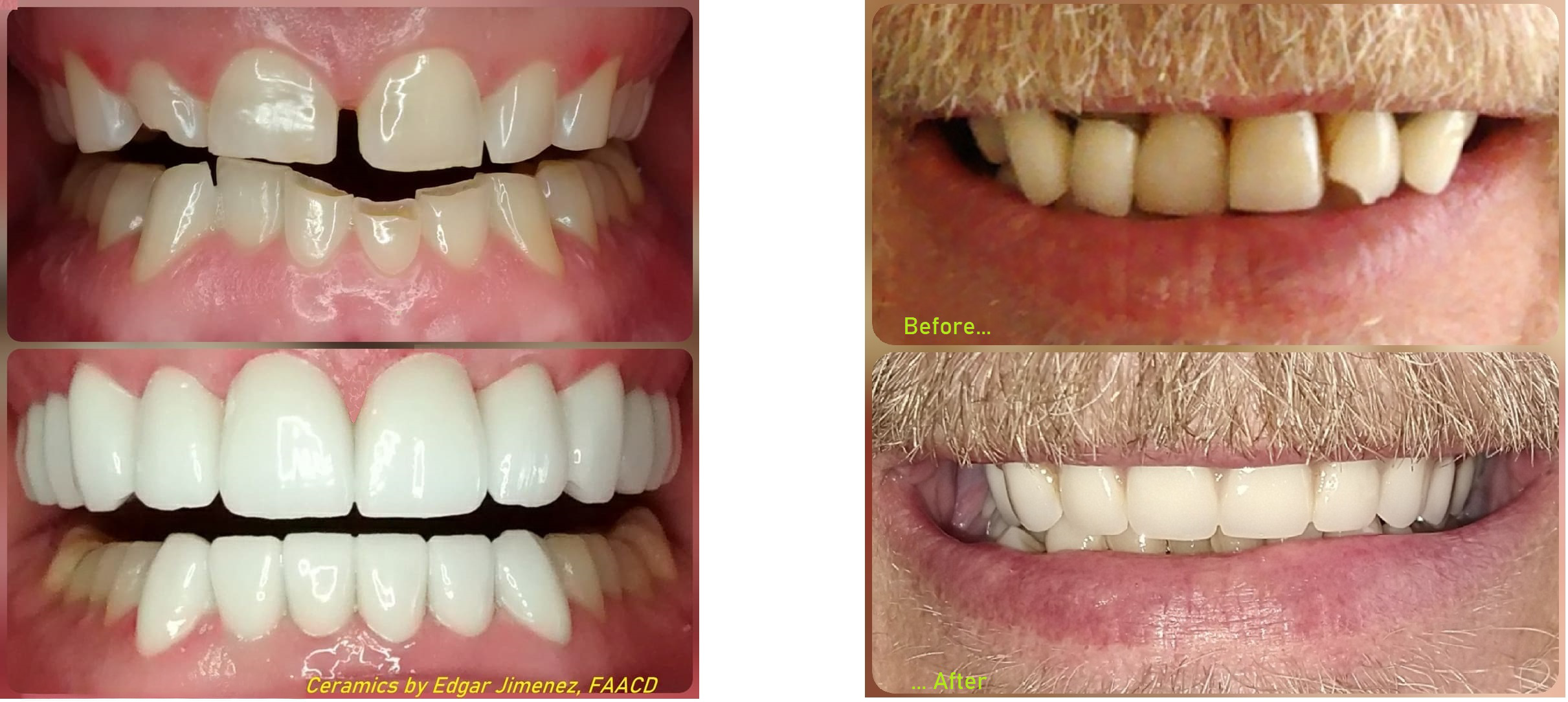 major dental overhaul reconstruction