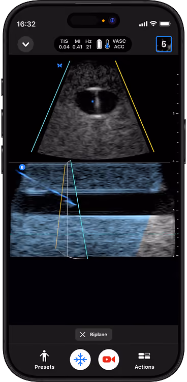 Handheld ultrasound app showing simultaneous biplane imaging and needle guidance for vascular access.