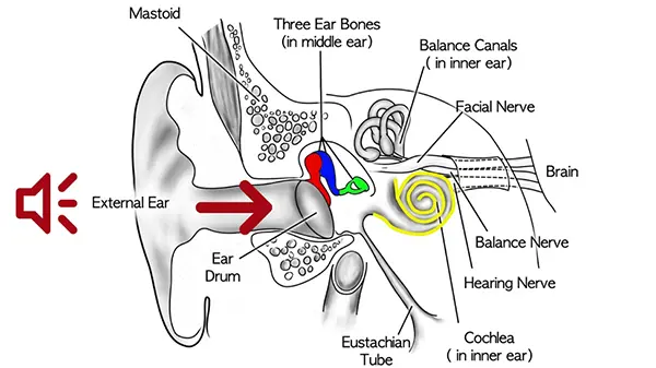 hearing loss diagram