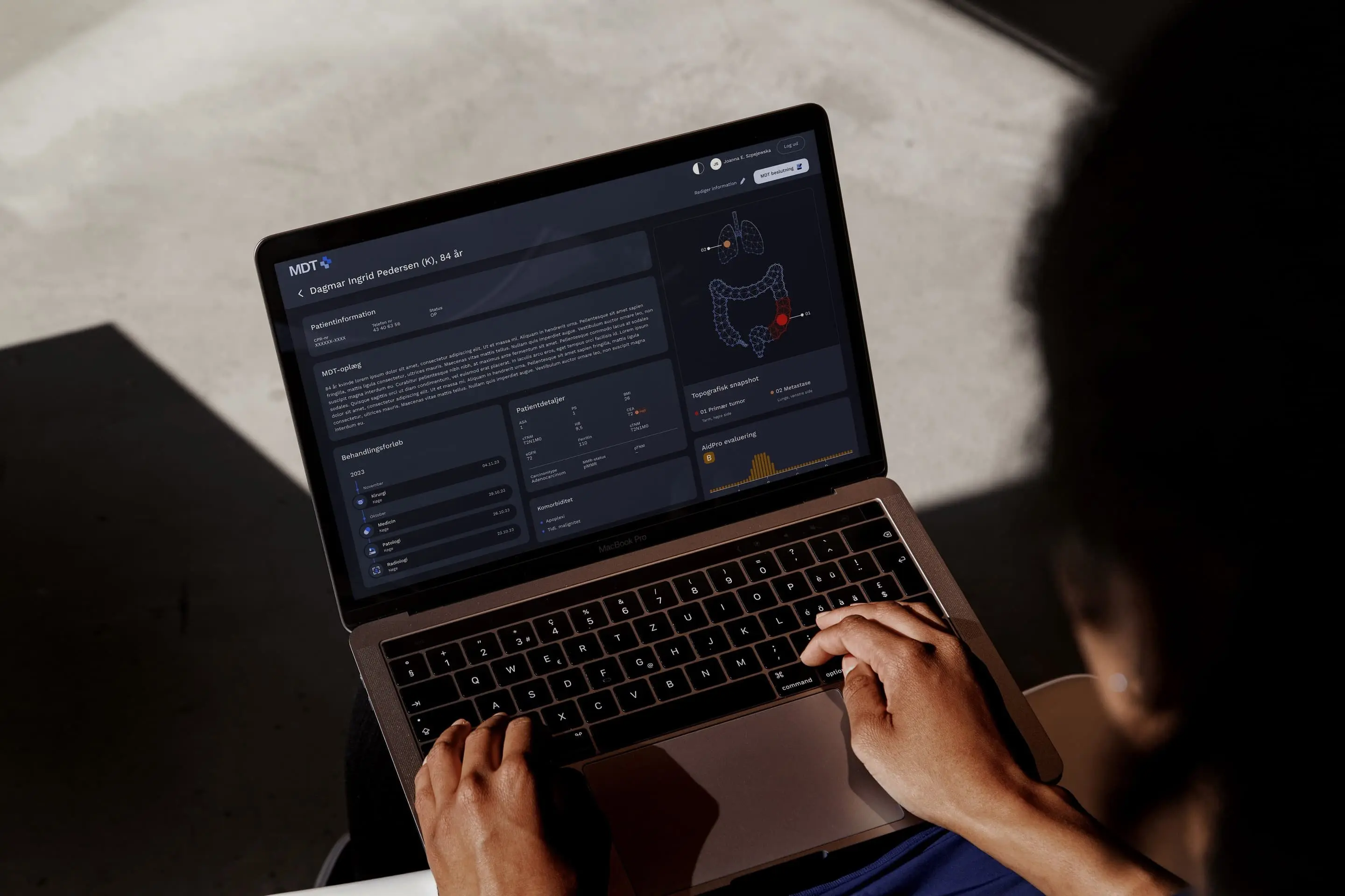 Person typing on a MacBook Pro displaying a dark-themed medical dashboard with patient information and anatomical diagrams.