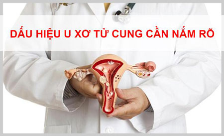 dấu hiệu u xơ tử cung