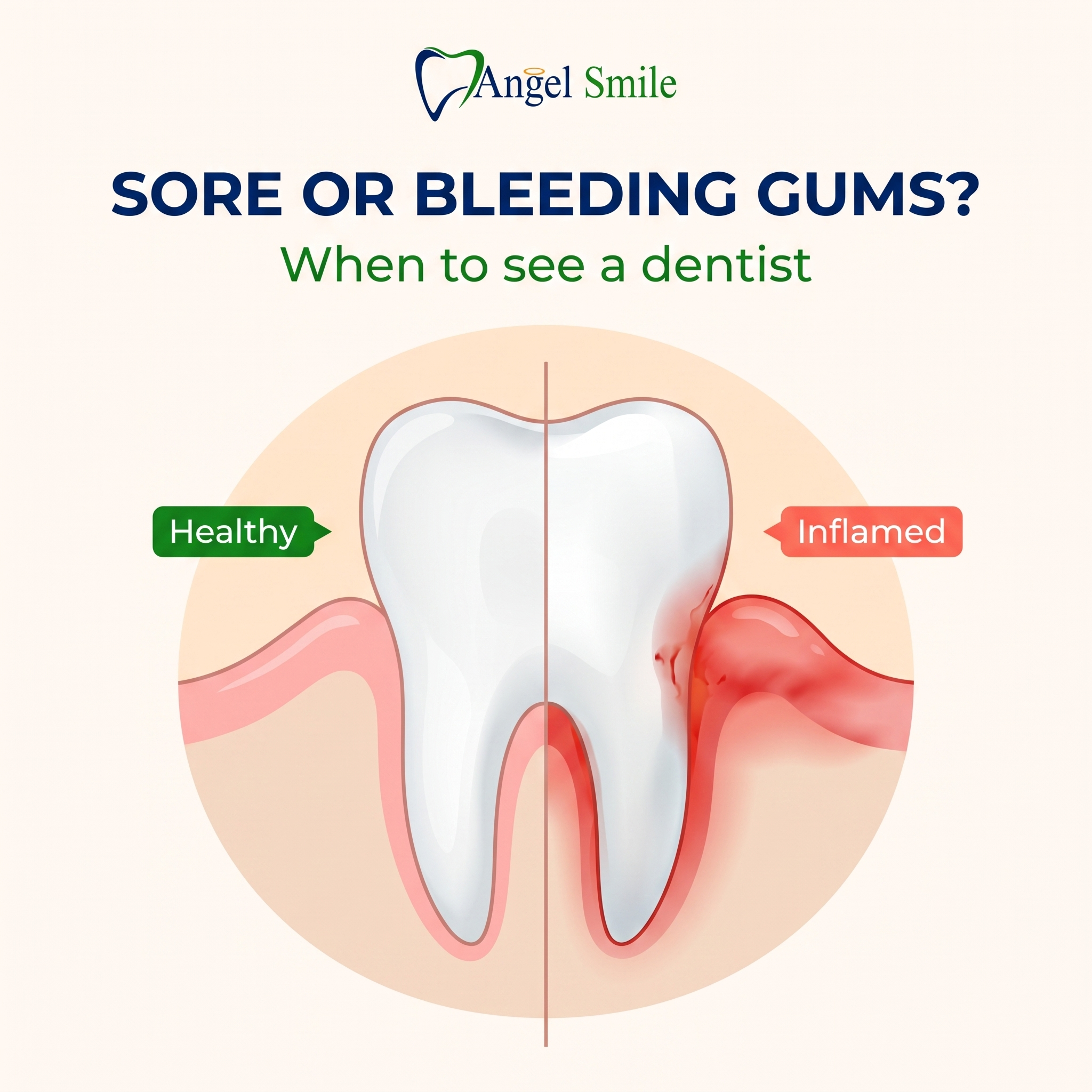 Healthy versus inflamed gums, Angel Smile Dental Group Chatsworth