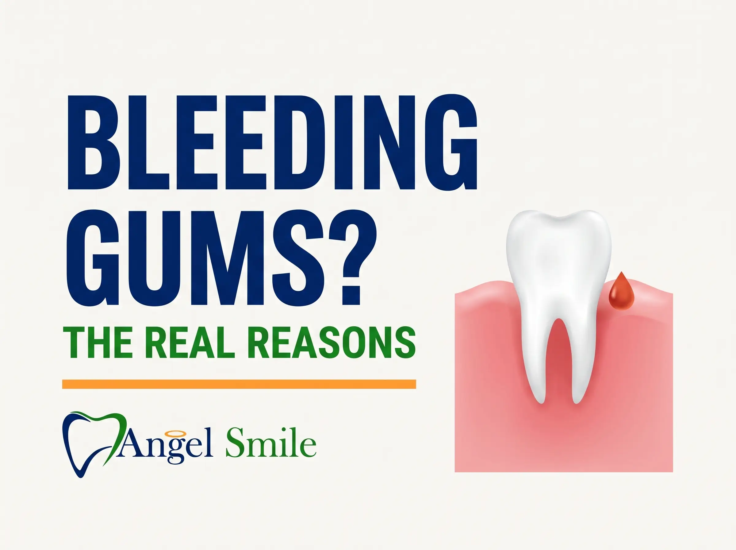 Bleeding Gums? The Real Reasons - Angel Smile Dental Group
