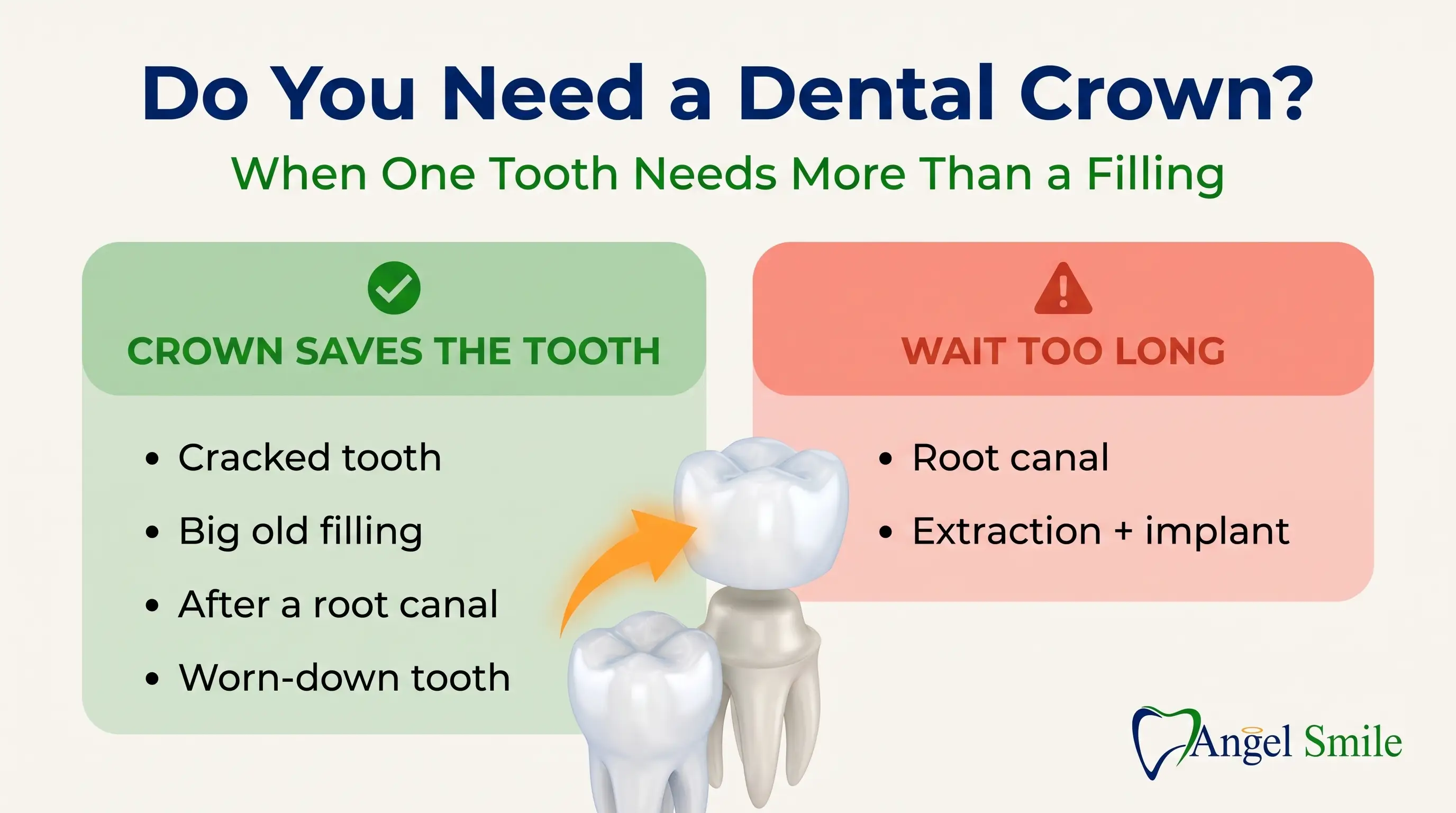 Dental crowns explained, when you need one and why, Angel Smile Dental Group