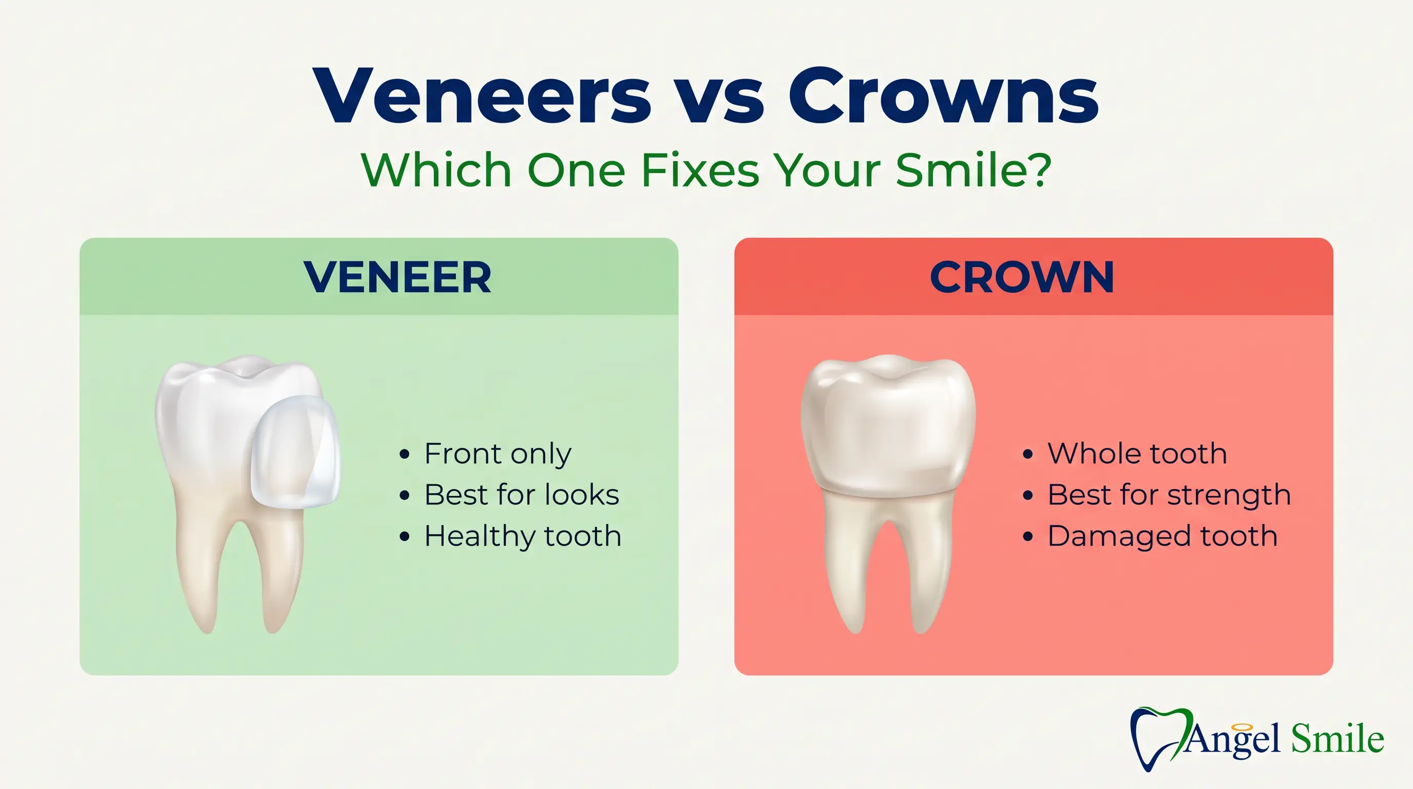 Veneers vs Crowns comparison infographic — Angel Smile Dental Group