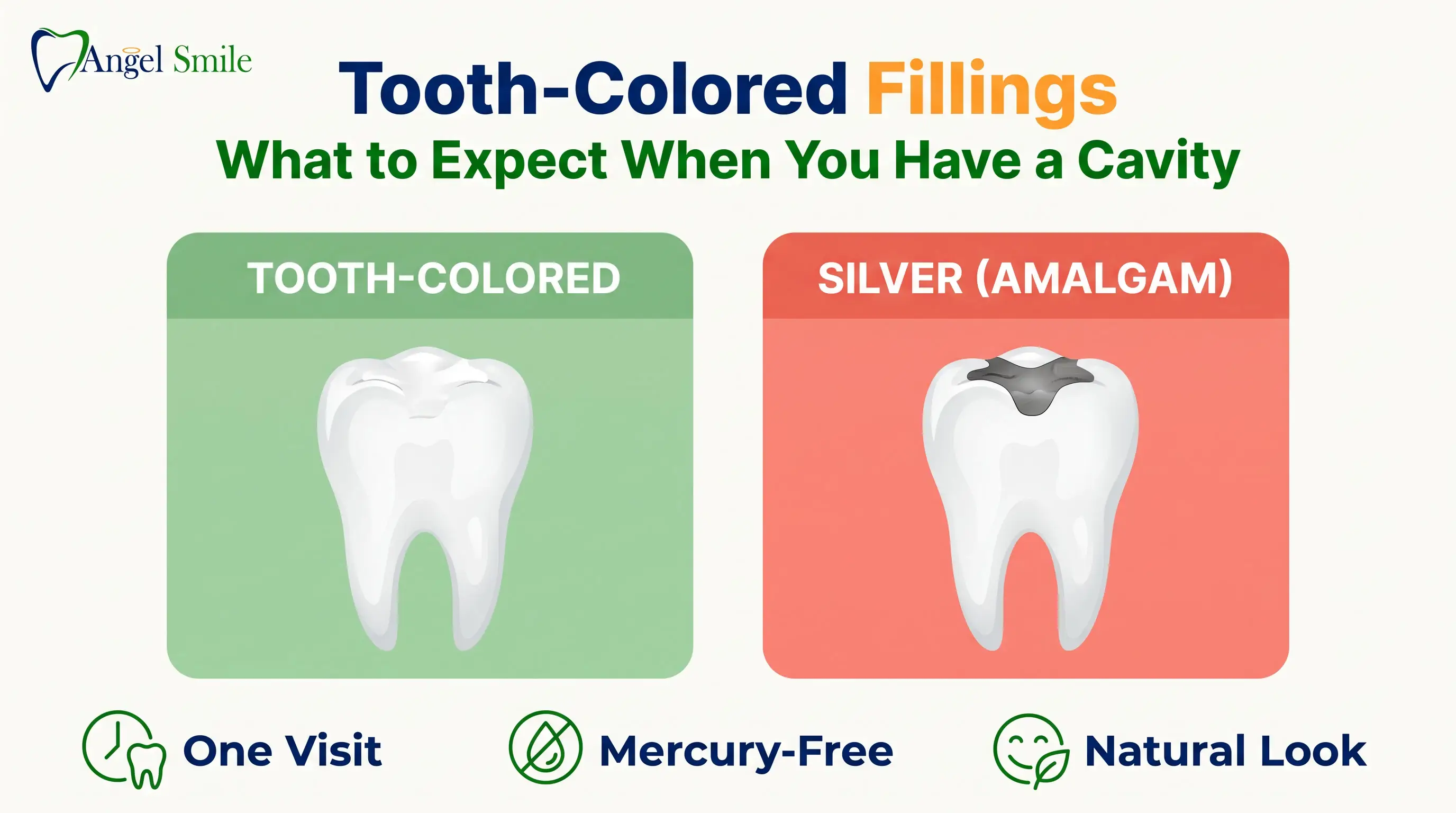 Tooth-Colored Fillings: What to Expect When You Have a Cavity — Angel Smile Dental Group