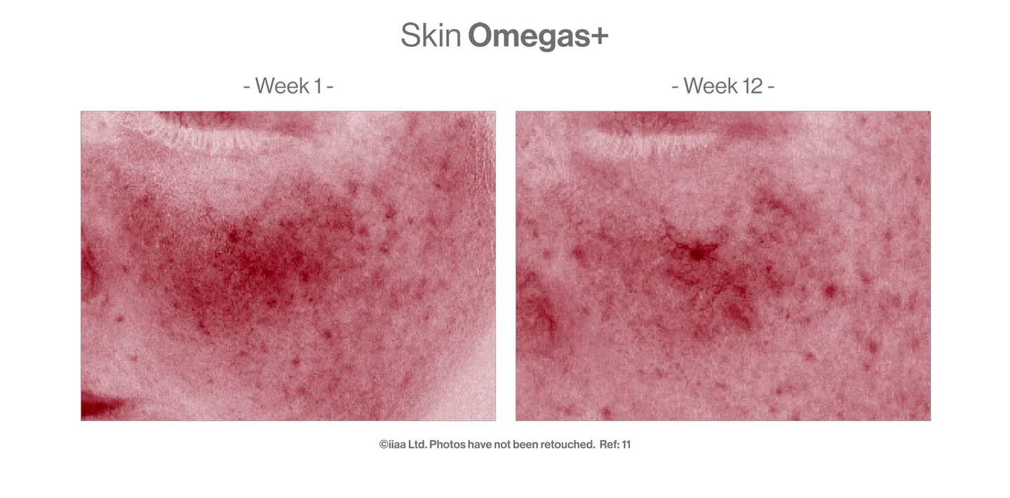 SKIN OMEGAS+, De kracht van Omega 3 + 6 (én vitamine A)