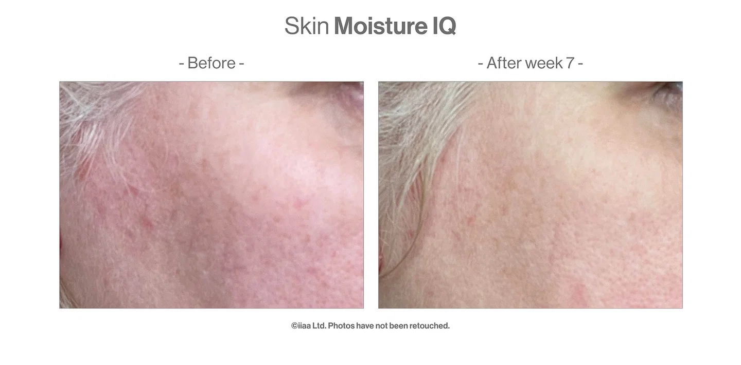 SKIN MOISTURE IQ. Unieke formule om de droge en vochtarme huid te hydrateren van binnenuit.