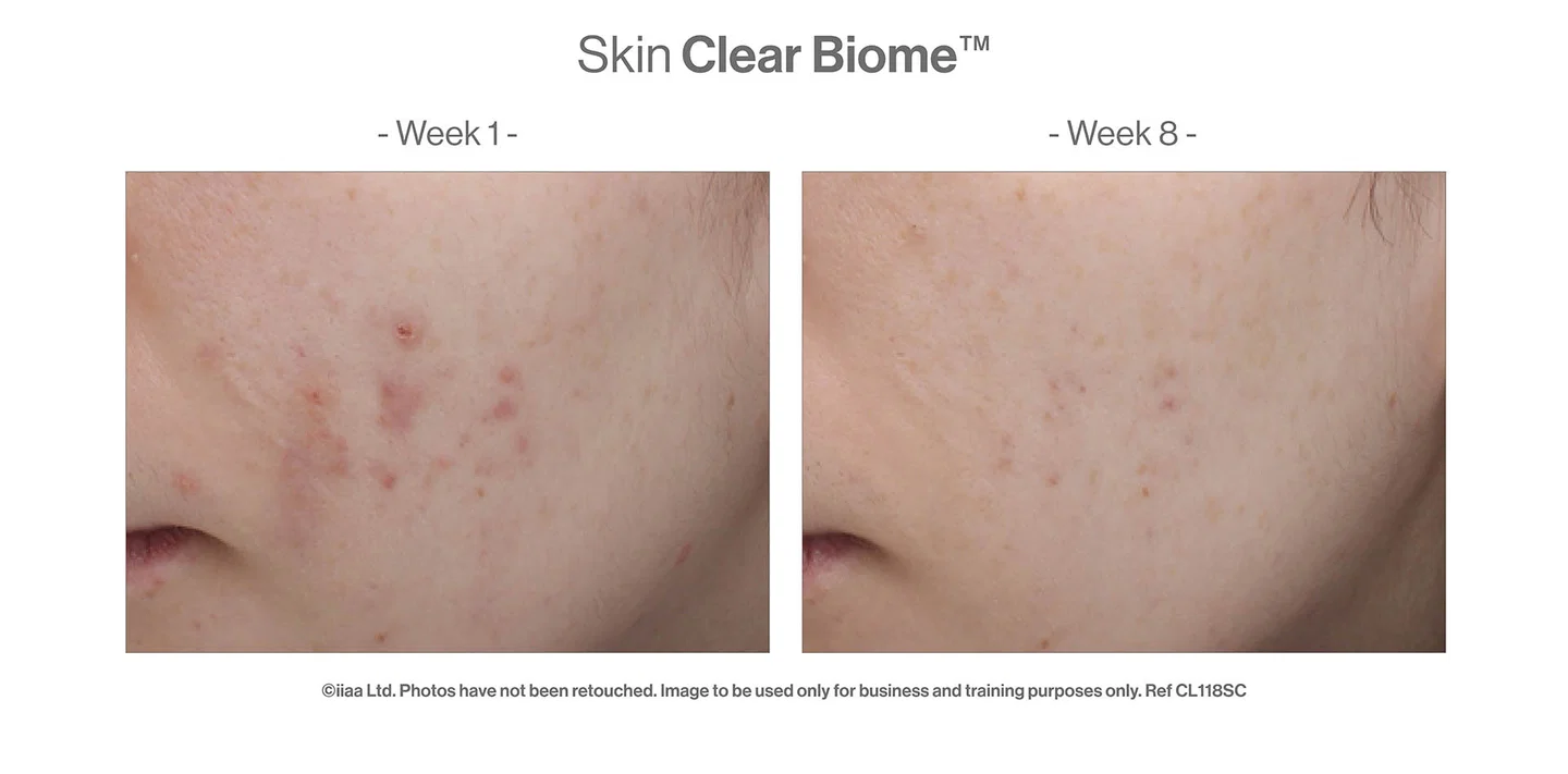 SKIN CLEAR BIOME™, een huidsupplement van de nieuwe generatie met innovatieve bioomtechnologie