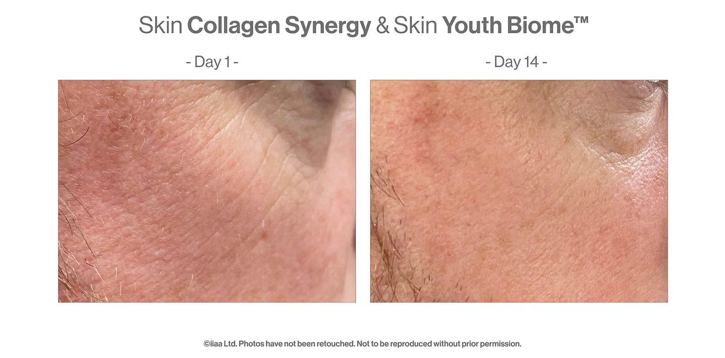 SKIN COLLAGEN SYNERGY, activeert het collageen van je huid.