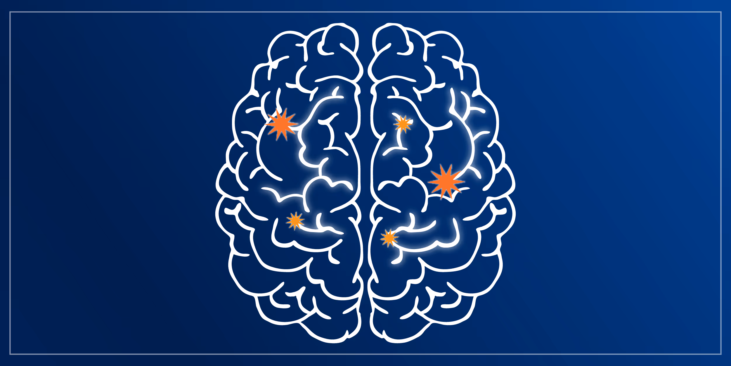 Illustration of a brain with sparks to represent thinking 