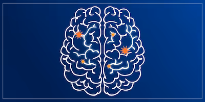 Illustration of a brain with sparks to represent thinking 