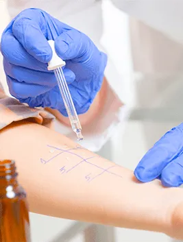 A close-up of a hand undergoing a skin test.