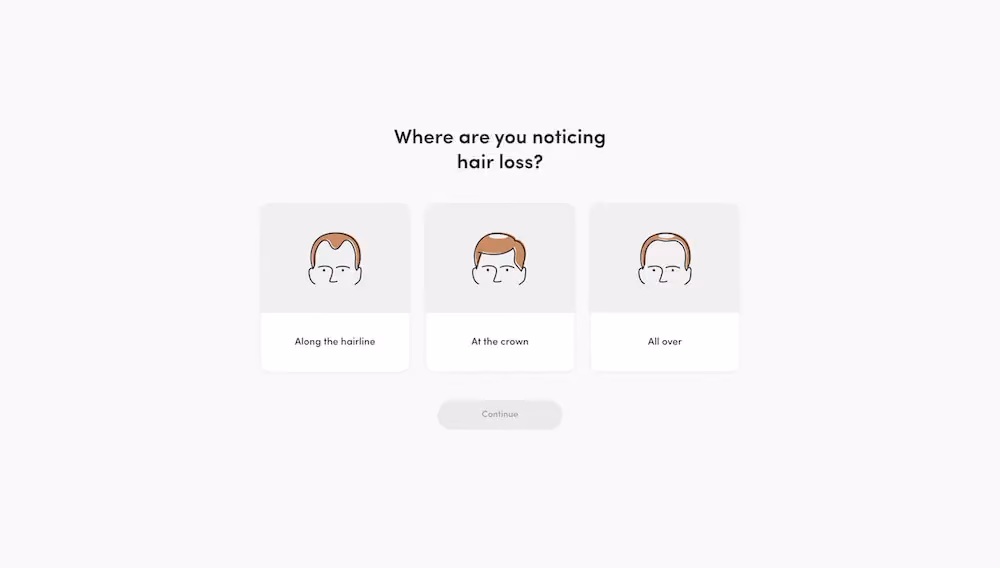 A quiz that appears once a site visitor clicks on "hair loss" in the segmentation survey. The quiz asks a variety of questions about the shopper's hair loss experience.