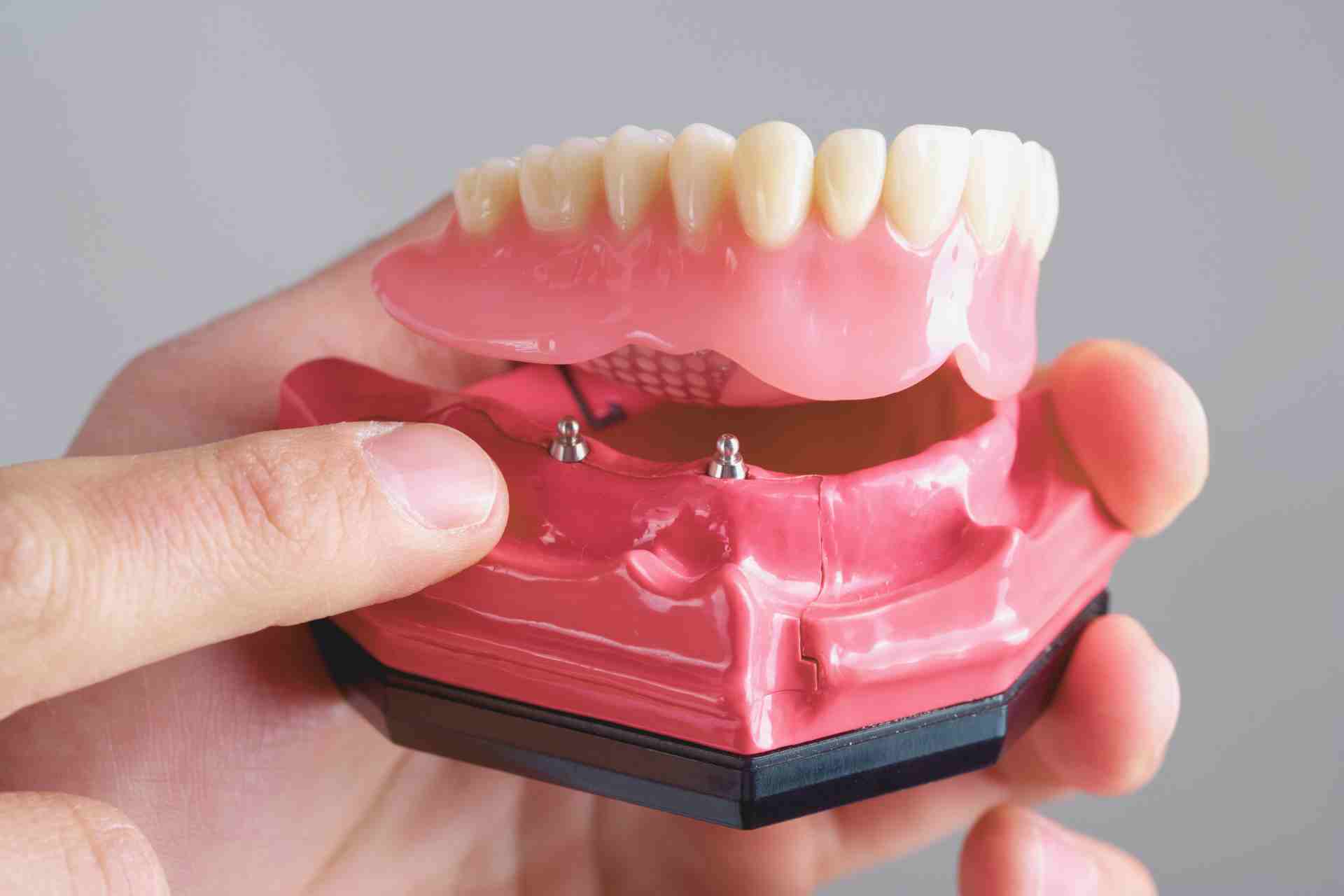 dental filling process