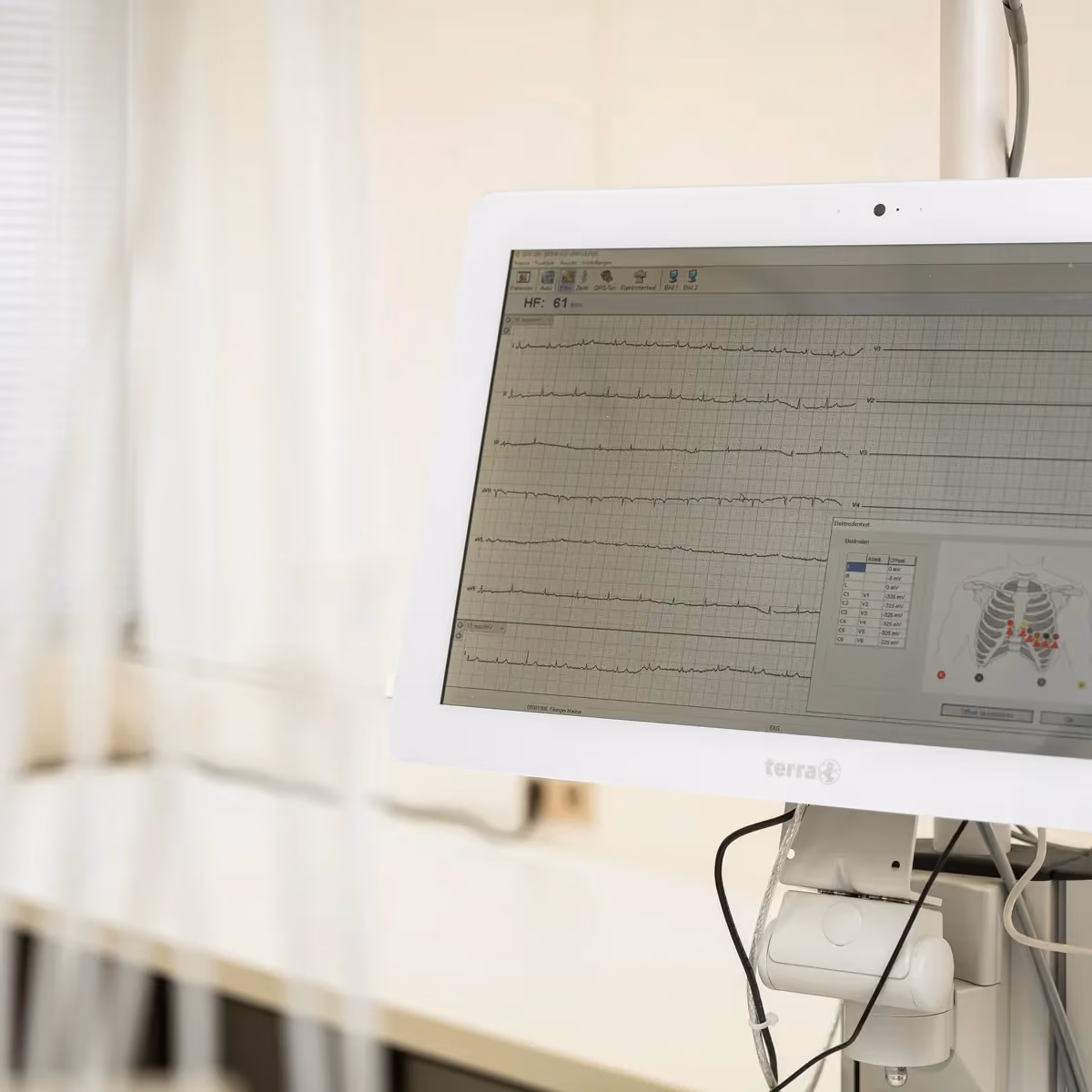 EKG-Monitor – MAS Gesundheitszentrum Stuttgart