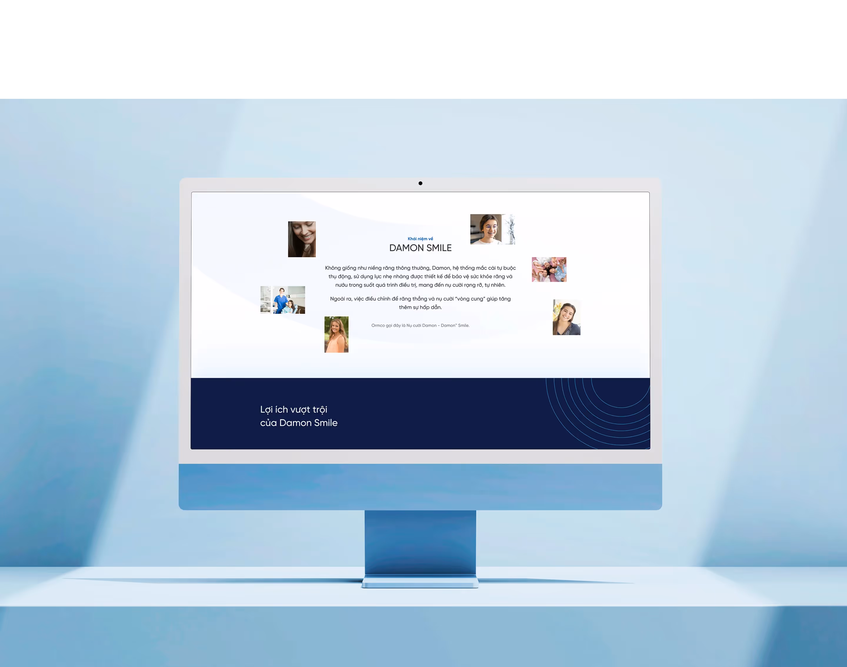 Damon Smile - Seadent