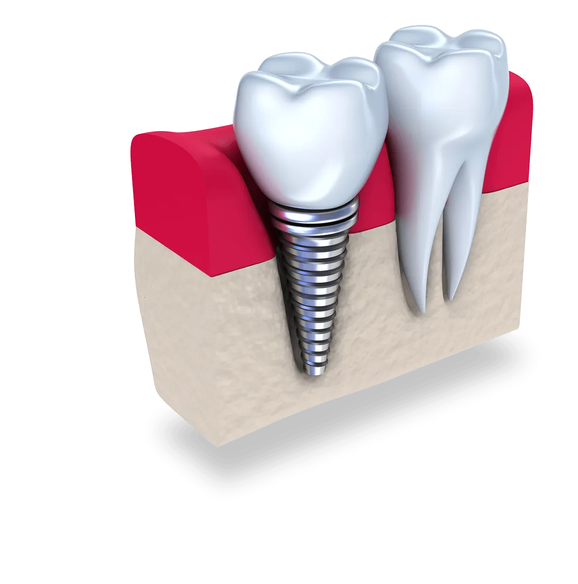 Shadowplants | Island Paradise Dental