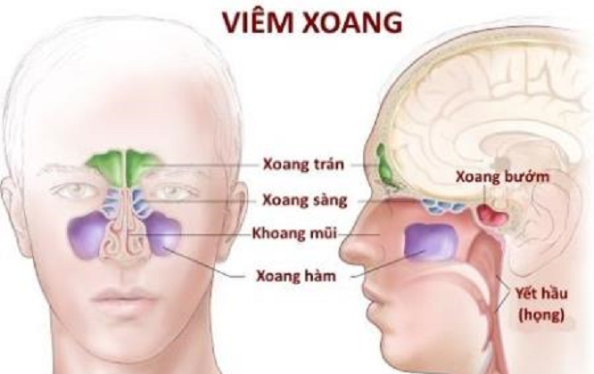 thuốc đông y trị viêm xoang viêm mũi dị ứng