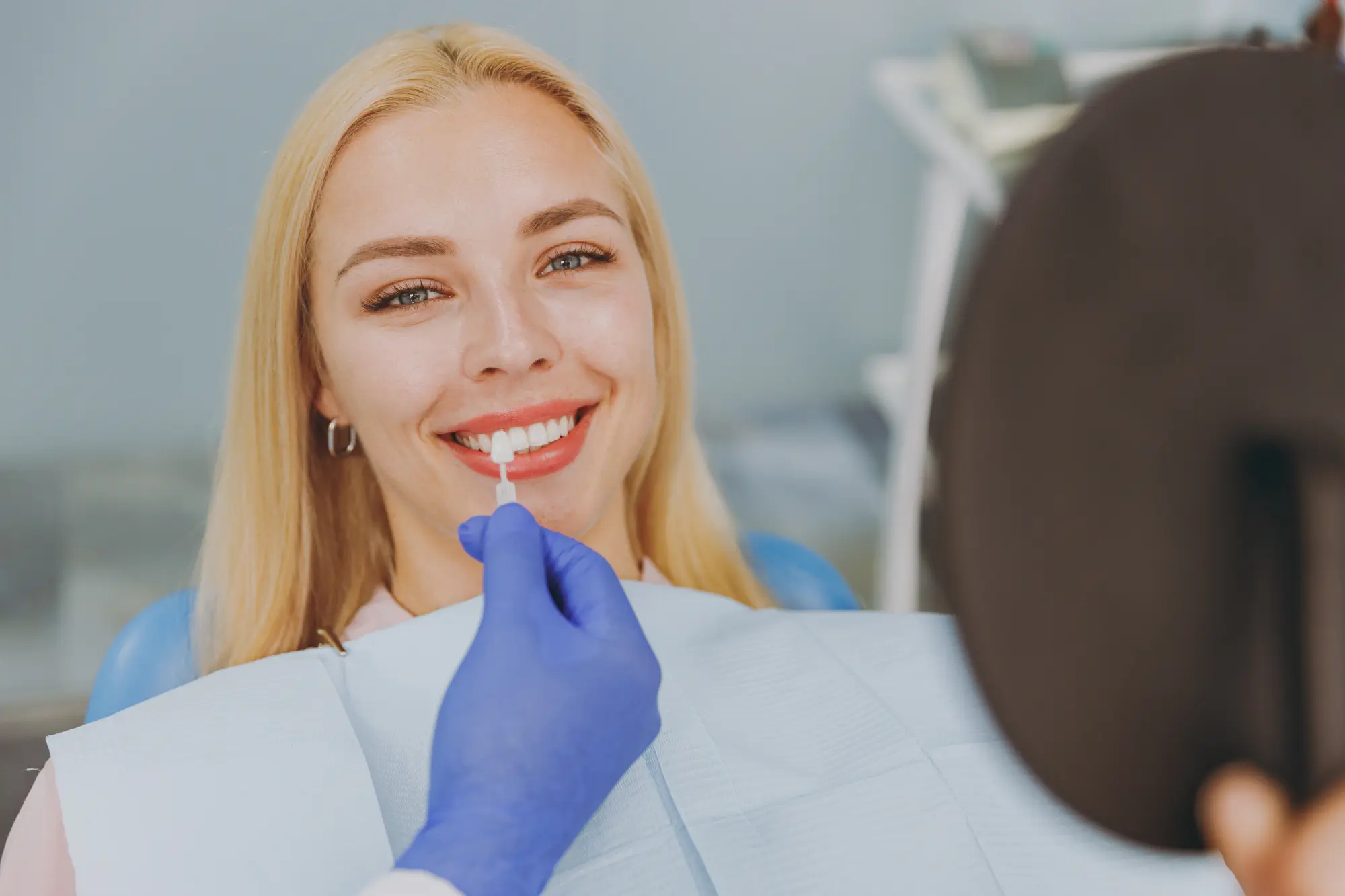 Do You Have to Replace Veneers?