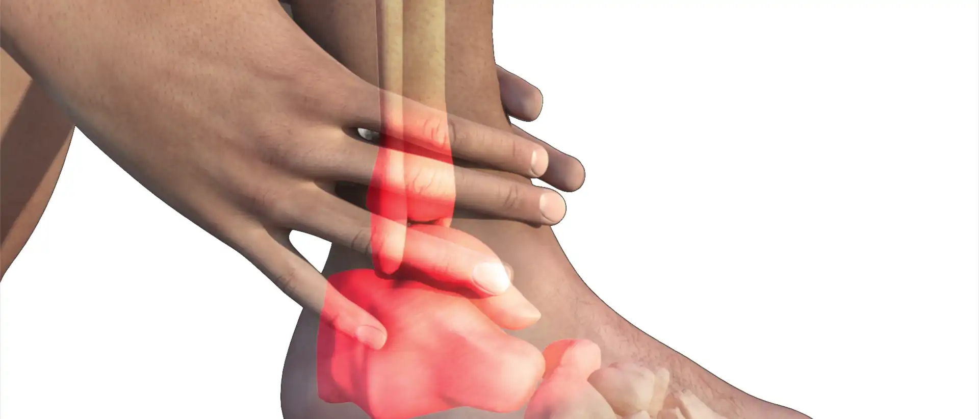 Opération du dôme de l'astragale 