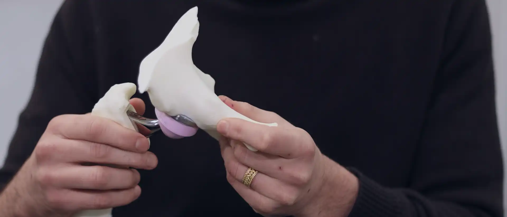 Prothèse totale de hanche