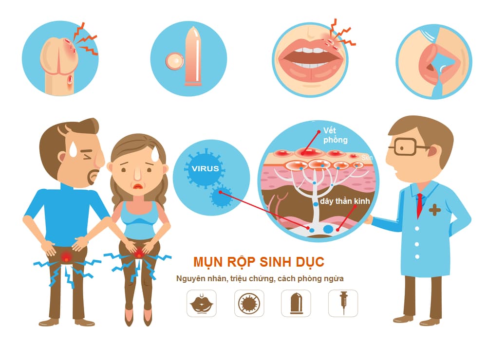 Mụn rộp sinh dục