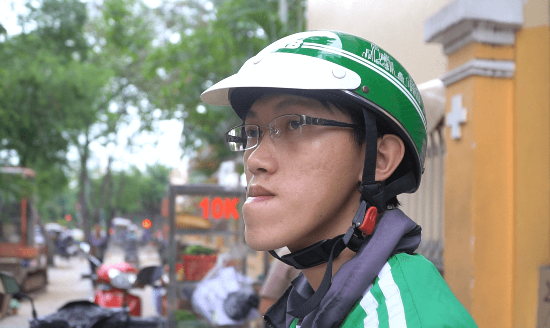 Hàm móm có di truyền không? Nguyên nhân gây móm là gì?