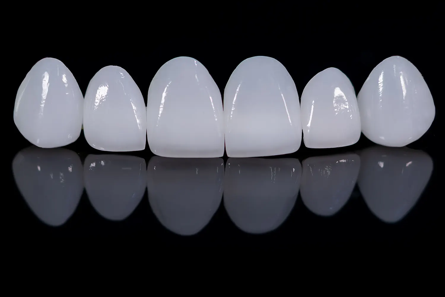 Porcelain Veneers in Raleigh: Achieving a Flawless, Natural-Looking Smile Transformation