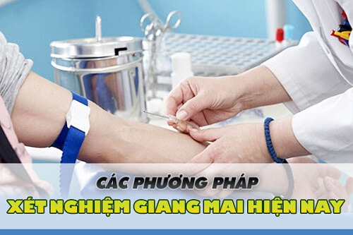 Các phương pháp xét nghiệm giang mai hiện nay