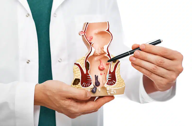 Cắt trĩ ở đâu tốt tại Vĩnh Phúc