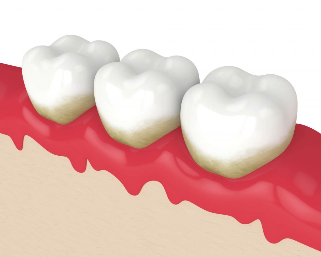 Who is the best Dentist Marco island Florida?