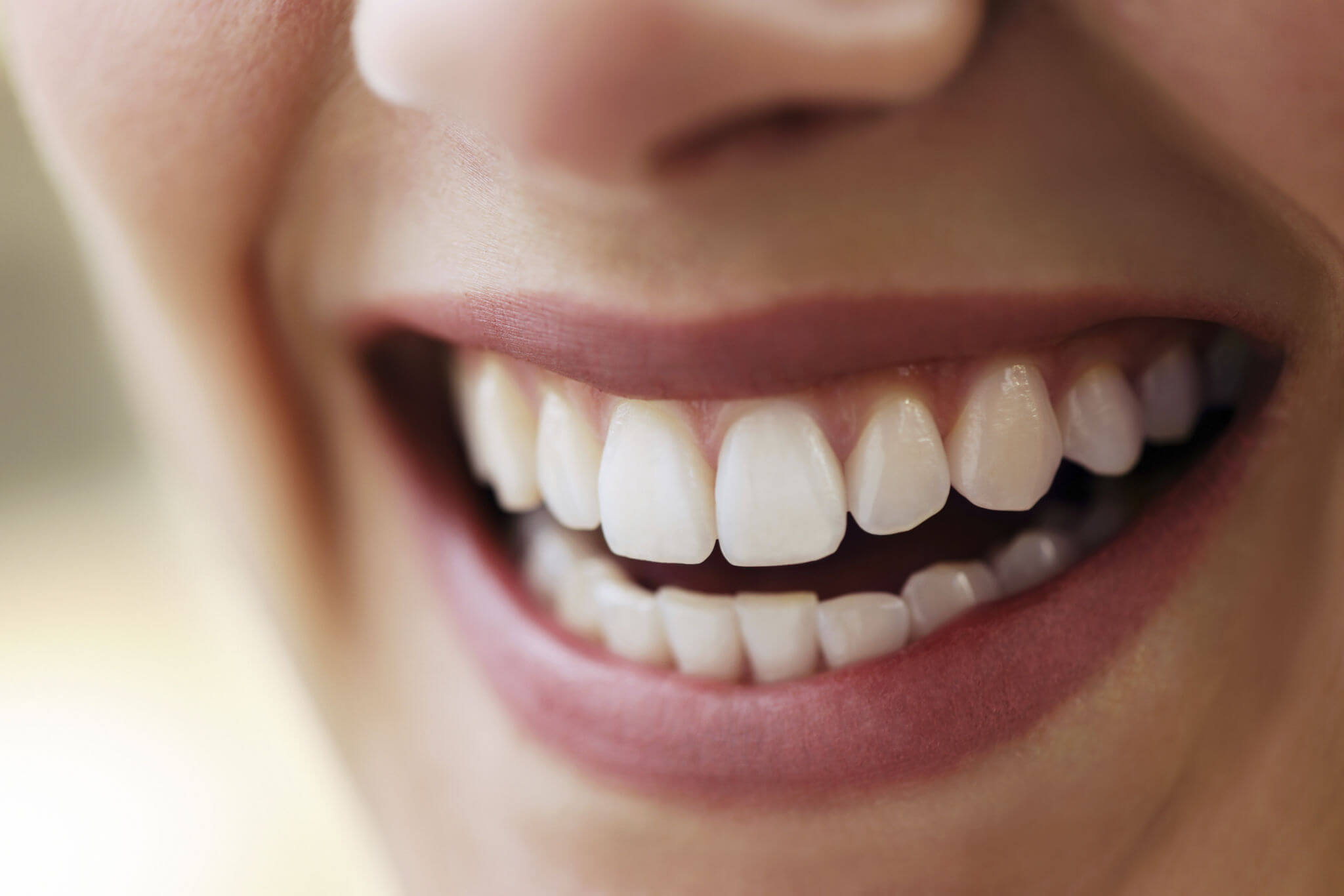 Beautiful dental work by Cosmetic dentists in Marco Island 