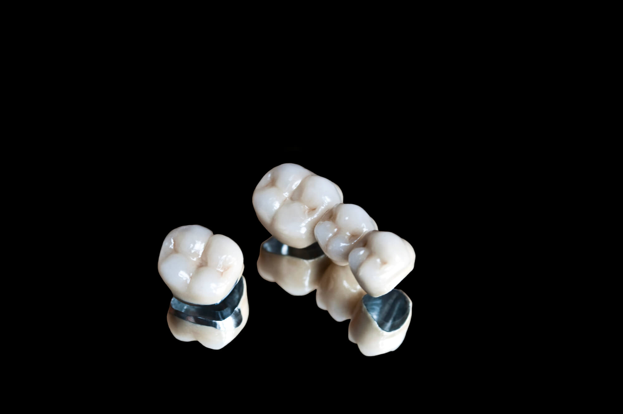 CEREC in Marco Island crowns