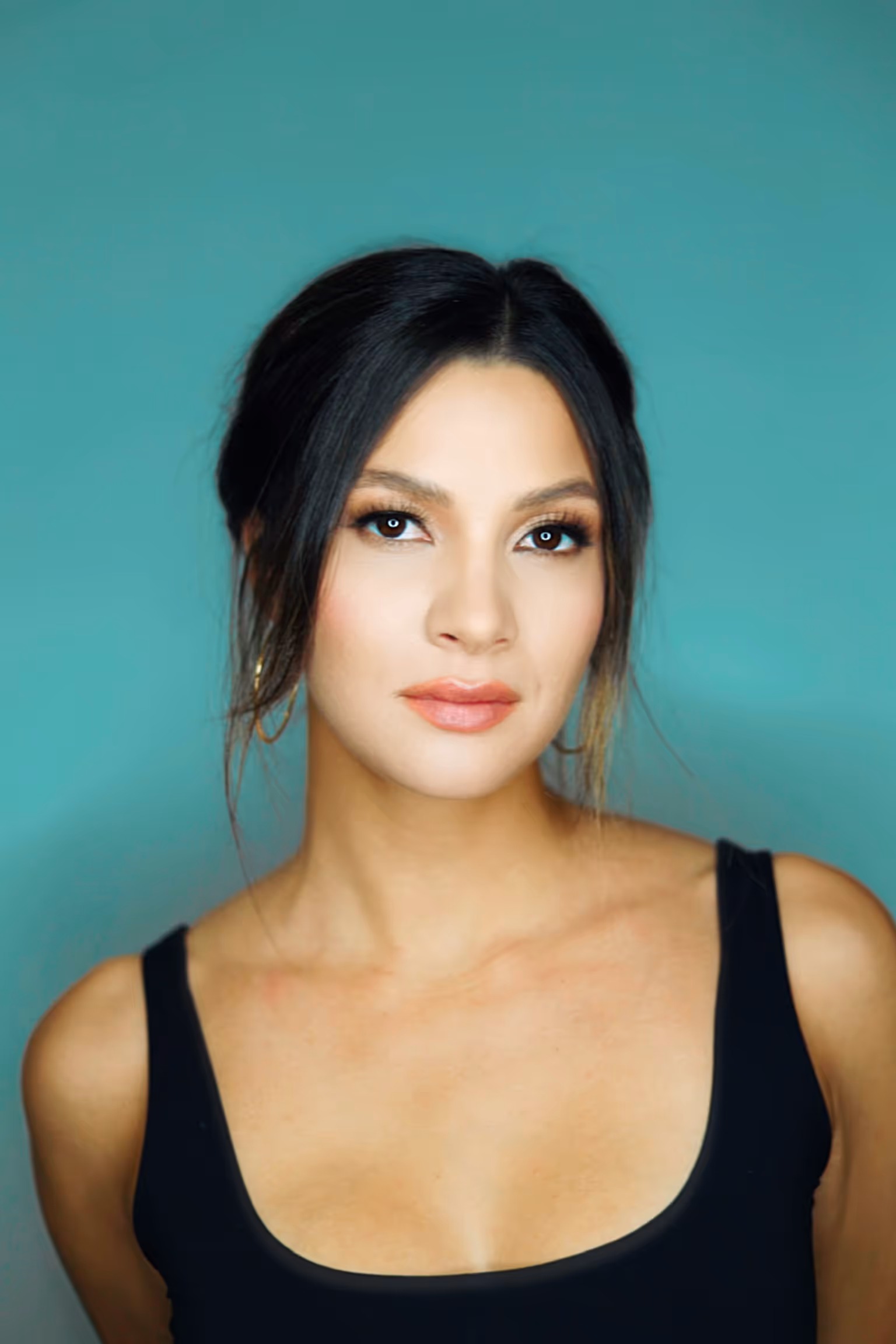 Dental bonding in Sarasota