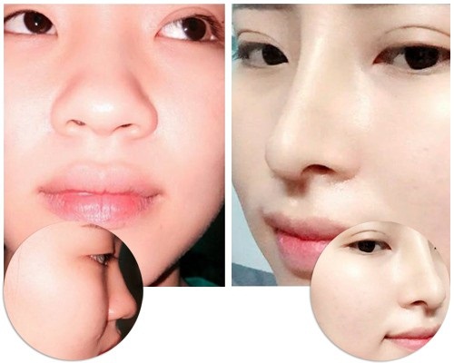 Hỏi Đáp: 