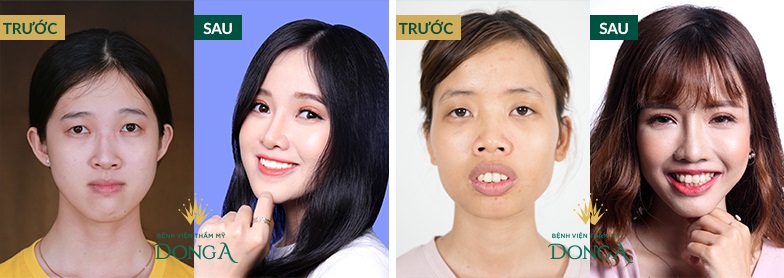Hỏi Đáp: 