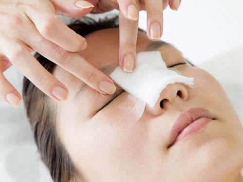 Cách tháo nẹp mũi tại nhà an toàn: 5 Lưu ý của Bác Sỹ Thẩm Mỹ - Hình 2
