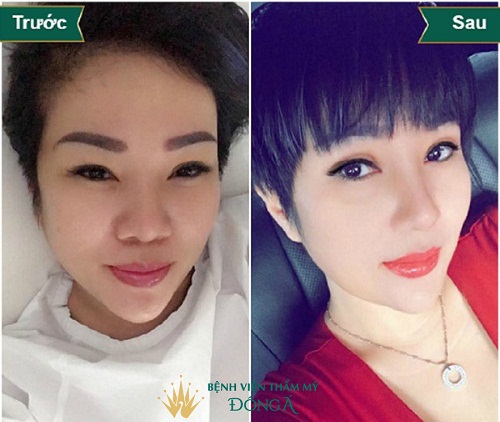 Cuộn cánh mũi Webtretho | 4 REVIEW chất nhất của các chị em - Hình 3