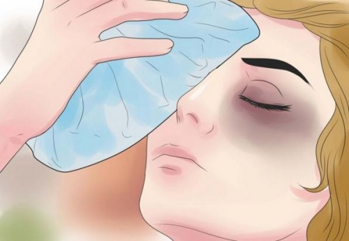 14 Cách vệ sinh mũi sau khi nâng giúp bạn Hồi Phục cực Nhanh - Hình 5