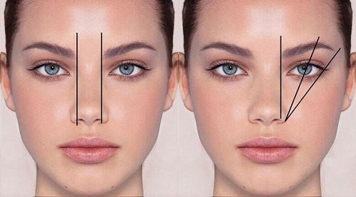 Cắt cánh mũi có nguy hiểm không? Liệu có được thon gọn vĩnh viễn? - Hình 3